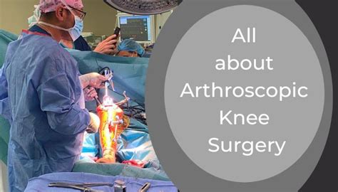 knee replacement greenwich|The Best Arthroscopic Surgeons in Greenwich .